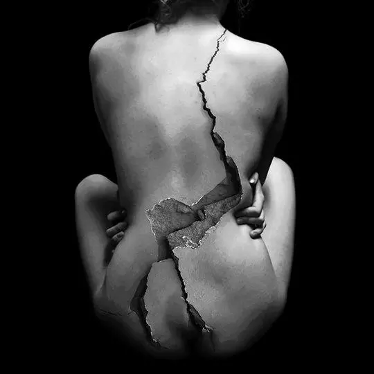 Fibromyalgie